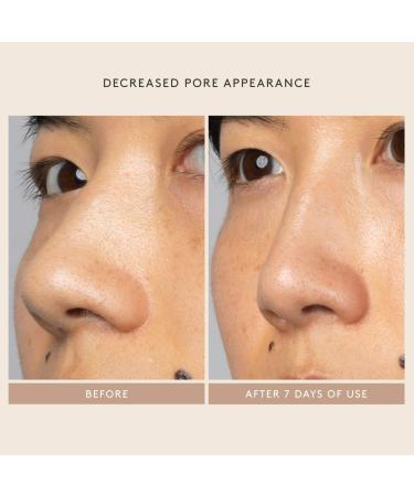 Shop Shani Darden Skin Care Lactic Acid AHA Exfoliating Serum - 1 oz / 30 ml Online - Best Price & International Shipping - Buy Online on GoSupps.com