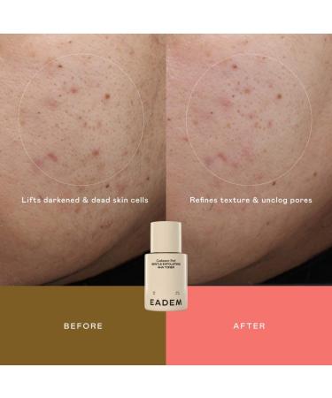 Shop EADEM Cashmere Peel Gentle AHA + PHA Exfoliating Toner with 9% Lactic Azelaic Tranexamic Acids - 5.07 oz Online - Best Price & International Shipping - Buy Online on GoSupps.com