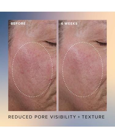 Shop Farmacy Honey Glow 17% AHA + BHA Resurfacing Acid Serum - 1 oz Online - Best Price & International Shipping - Buy Online on GoSupps.com