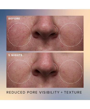 Shop Farmacy Honey Glow 17% AHA + BHA Resurfacing Acid Serum - 1 oz Online - Best Price & International Shipping - Buy Online on GoSupps.com