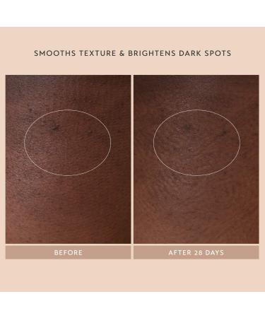 Shop Shani Darden Skin Care Body Reform Treatment Serum with 2% Granactive Retinoid - 4 oz / 120 ml Online - Best Price & International Shipping - Buy Online on GoSupps.com