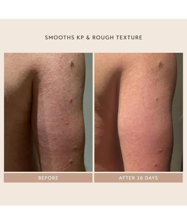 Shop Shani Darden Skin Care Body Reform Treatment Serum with 2% Granactive Retinoid - 4 oz / 120 ml Online - Best Price & International Shipping - Buy Online on GoSupps.com