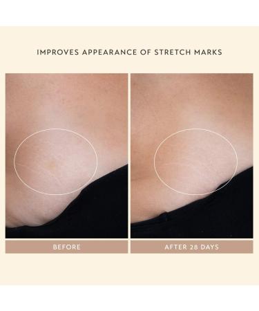 Shop Shani Darden Skin Care Body Reform Treatment Serum with 2% Granactive Retinoid - 4 oz / 120 ml Online - Best Price & International Shipping - Buy Online on GoSupps.com