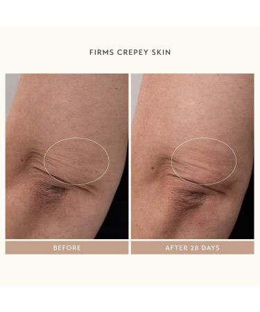 Shop Shani Darden Skin Care Body Reform Treatment Serum with 2% Granactive Retinoid - 4 oz / 120 ml Online - Best Price & International Shipping - Buy Online on GoSupps.com