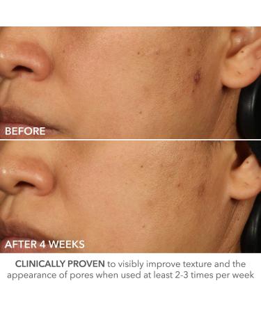 Shop Dr. Dennis Gross Skincare Advanced Retinol + Ferulic Perfectly Dosed Retinol Extra Strength 0.5%						 - 8 Treatments / Pack Online - Best Price & International Shipping - Buy Online on GoSupps.com