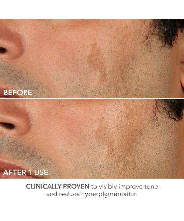 Shop Dr. Dennis Gross Skincare Advanced Retinol + Ferulic Perfectly Dosed Retinol Extra Strength 0.5%						 - 8 Treatments / Pack Online - Best Price & International Shipping - Buy Online on GoSupps.com