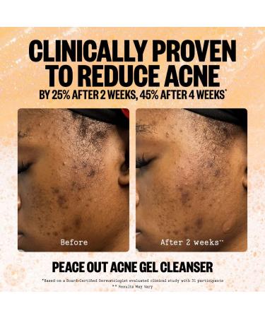Shop Peace Out 2% Salicylic Acid Acne Gel Cleanser - 4 oz Online - Best Price & International Shipping - Buy Online on GoSupps.com