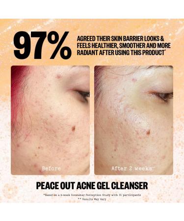 Shop Peace Out 2% Salicylic Acid Acne Gel Cleanser - 4 oz Online - Best Price & International Shipping - Buy Online on GoSupps.com