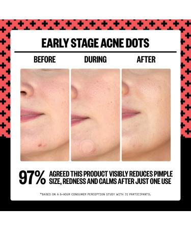 Shop Peace Out 2% Salicylic Acid Early Stage Acne Dot - 8 Patches Online - Best Price & International Shipping - Buy Online on GoSupps.com