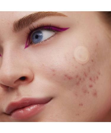 Shop Peace Out 2% Salicylic Acid Early Stage Acne Dot - 8 Patches Online - Best Price & International Shipping - Buy Online on GoSupps.com