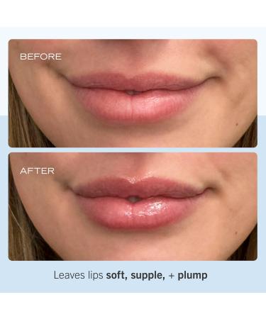 Shop First Aid Beauty Ultra Repair Lip Balm - 0.25 oz / 6 g Online - Best Price & International Shipping - Buy Online on GoSupps.com