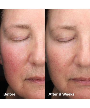 Shop Paula's Choice Skin Perfecting 6% Mandelic Acid + 2% Lactic Acid Liquid Exfoliant - 3 oz Online - Best Price & International Shipping - Buy Online on GoSupps.com