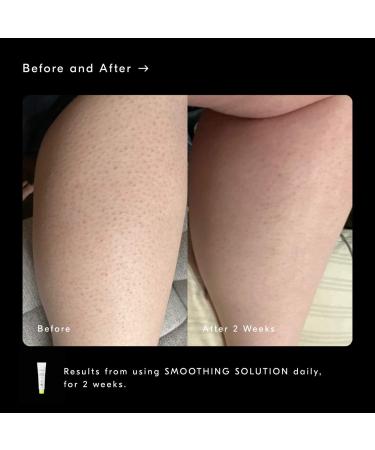 Shop Soft Services the body skin experts Bestsellers Discovery Set Online - Best Price & International Shipping - Buy Online on GoSupps.com
