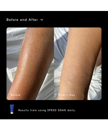 Shop Soft Services the body skin experts Bestsellers Discovery Set Online - Best Price & International Shipping - Buy Online on GoSupps.com