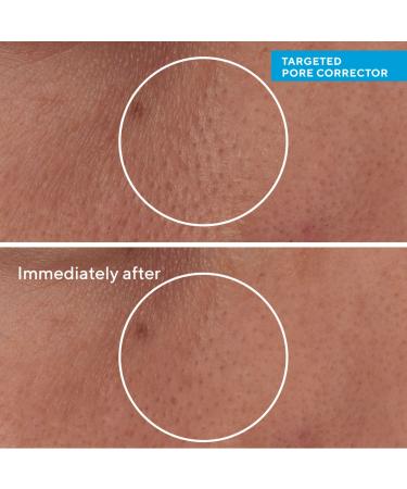 Shop Murad 5 Minute Fix: Targeted Correctors Set Online - Best Price & International Shipping - Buy Online on GoSupps.com