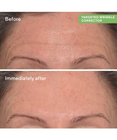 Shop Murad 5 Minute Fix: Targeted Correctors Set Online - Best Price & International Shipping - Buy Online on GoSupps.com