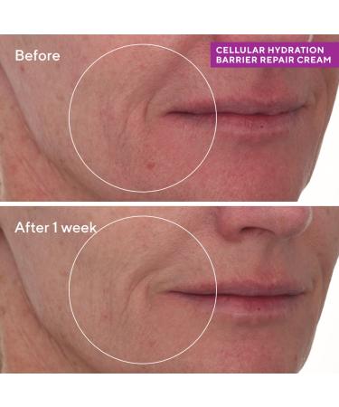 Shop Murad Cellular Hydration Repair Cream - 1.7 oz / 50 ml Online - Best Price & International Shipping - Buy Online on GoSupps.com