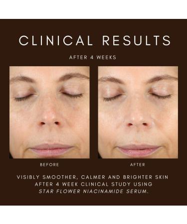 Shop Saint Jane Beauty Star Flower Hydration Serum with Niacinamide and Hyaluronic Acid - 1.5 oz Online - Best Price & International Shipping - Buy Online on GoSupps.com