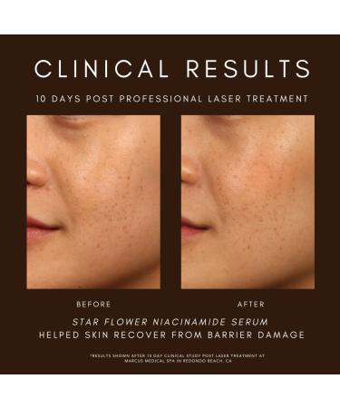 Shop Saint Jane Beauty Star Flower Hydration Serum with Niacinamide and Hyaluronic Acid - 1.5 oz Online - Best Price & International Shipping - Buy Online on GoSupps.com