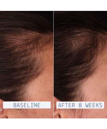 Shop AAVRANI Hair Density Boosting Scalp Serum for Thinning Hair & Hair Loss - 2 oz / 60 ml - 4 Month Supply Online - Best Price & International Shipping - Buy Online on GoSupps.com