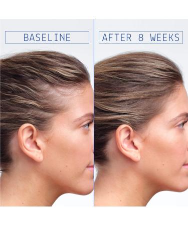 Shop AAVRANI Hair Density Boosting Scalp Serum for Thinning Hair & Hair Loss - 2 oz / 60 ml - 4 Month Supply Online - Best Price & International Shipping - Buy Online on GoSupps.com