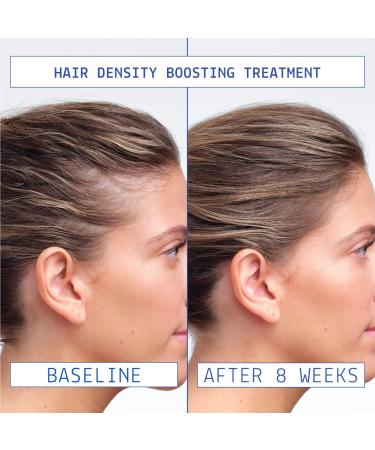 Shop AAVRANI Mini Strengthening Hair Oil & Growth Serum Gift Set Online - Best Price & International Shipping - Buy Online on GoSupps.com