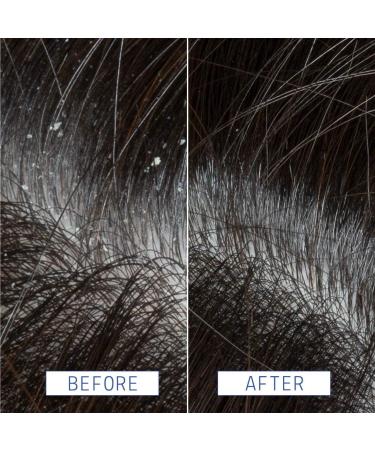 Shop AAVRANI Anti-Dandruff Scalp Serum with Salicylic Acid For Congested + Flaky Scalp - 2 oz Online - Best Price & International Shipping - Buy Online on GoSupps.com