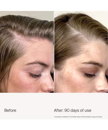 Shop Living Proof Scalp Care Density Serum for Thinning & Greying Hair - 1.7 oz / 50 mL Online - Best Price & International Shipping - Buy Online on GoSupps.com