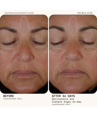 Shop Dieux Deliverance Antioxidant & Niacinamide Serum for Calm & Even Skin - 1 oz Online - Best Price & International Shipping - Buy Online on GoSupps.com