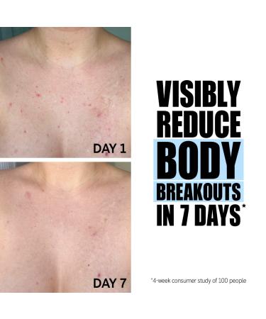 Shop The INKEY List Glycolic Acid Exfoliating Body Stick - 1.5 oz Online - Best Price & International Shipping - Buy Online on GoSupps.com