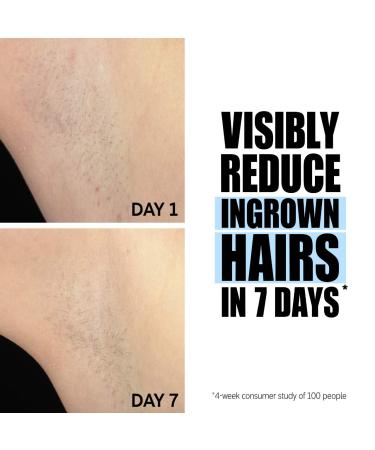 Shop The INKEY List Glycolic Acid Exfoliating Body Stick - 1.5 oz Online - Best Price & International Shipping - Buy Online on GoSupps.com