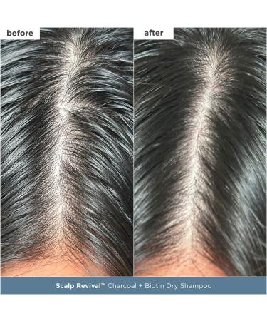 Shop Briogeo Scalp Revival Scalp Care Essentials Kit Online - Best Price & International Shipping - Buy Online on GoSupps.com