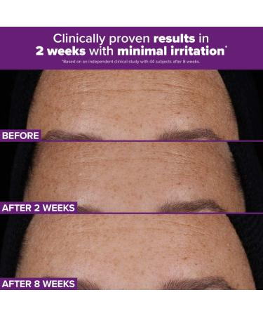 Shop Paula's Choice Clinical PRO Retinaldehyde Dual-Retinoid Treatment for Clear Luminous Skin - 1 oz / 30 mL Online - Best Price & International Shipping - Buy Online on GoSupps.com