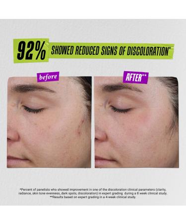 Shop Kiehl's Since 1851 Auto-Tone Skin Discoloration Treatment with SPF 30 - 1.3 oz / 40 ml Online - Best Price & International Shipping - Buy Online on GoSupps.com
