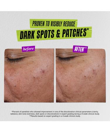Shop Kiehl's Since 1851 Auto-Tone Skin Discoloration Treatment with SPF 30 - 1.3 oz / 40 ml Online - Best Price & International Shipping - Buy Online on GoSupps.com