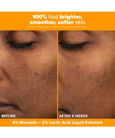 Shop Paula's Choice Brighter Days Ahead Kit with Vitamin C and AHA for Discoloration Online - Best Price & International Shipping - Buy Online on GoSupps.com