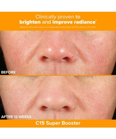 Shop Paula's Choice Brighter Days Ahead Kit with Vitamin C and AHA for Discoloration Online - Best Price & International Shipping - Buy Online on GoSupps.com