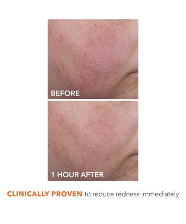 Shop Dr. Dennis Gross Skincare DermInfusions Blur + Repair Cream with Hyaluronic Acid and Peptides - 1.7 oz / 50 ml Online - Best Price & International Shipping - Buy Online on GoSupps.com