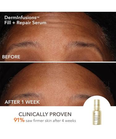 Shop Dr. Dennis Gross Skincare DermInfusions Plump Fill + Repair Kit Online - Best Price & International Shipping - Buy Online on GoSupps.com