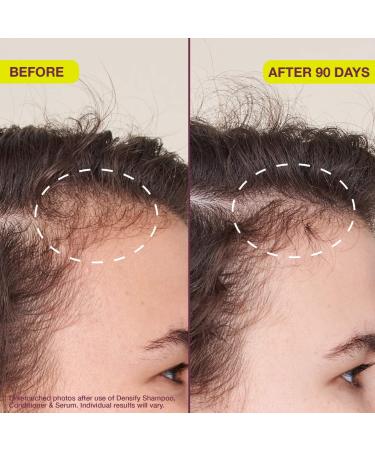 Shop The Rootist Densifying & Thickening Serum for Thinning Hair - 1 oz / 30 mL Online - Best Price & International Shipping - Buy Online on GoSupps.com