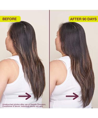 Shop The Rootist Densifying & Thickening Serum for Thinning Hair - 1 oz / 30 mL Online - Best Price & International Shipping - Buy Online on GoSupps.com