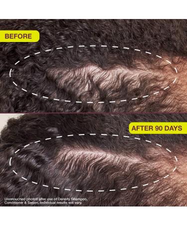 Shop The Rootist Densifying & Thickening Serum for Thinning Hair - 1 oz / 30 mL Online - Best Price & International Shipping - Buy Online on GoSupps.com