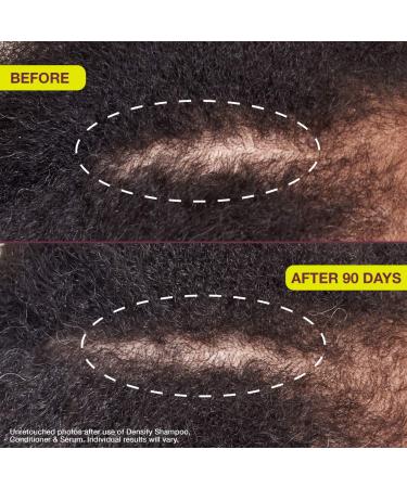 Shop The Rootist Densifying & Thickening Serum for Thinning Hair - 1 oz / 30 mL Online - Best Price & International Shipping - Buy Online on GoSupps.com