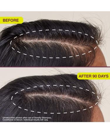 Shop The Rootist Densifying & Thickening Serum for Thinning Hair - 1 oz / 30 mL Online - Best Price & International Shipping - Buy Online on GoSupps.com