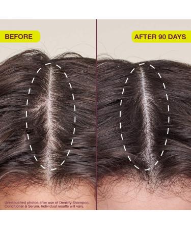 Shop The Rootist Densifying & Thickening Serum for Thinning Hair - 1 oz / 30 mL Online - Best Price & International Shipping - Buy Online on GoSupps.com