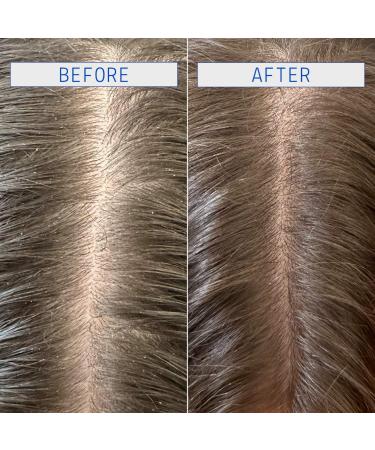 Shop AAVRANI Jelly Clarifying Detox Shampoo for Scalp & Hair - 8.4 oz / 250 ml Online - Best Price & International Shipping - Buy Online on GoSupps.com