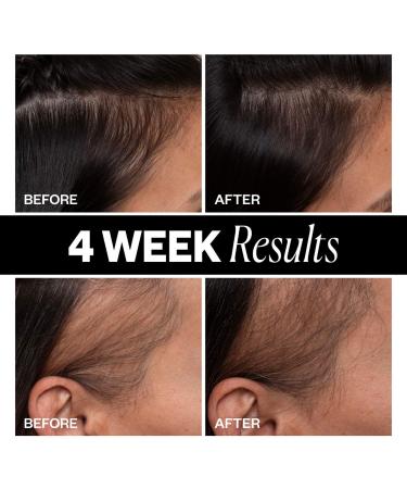 Shop IGK Sponsored Hair Density Scalp Treatment for Thinning Hair - 2.1 oz / 63 ml Online - Best Price & International Shipping - Buy Online on GoSupps.com