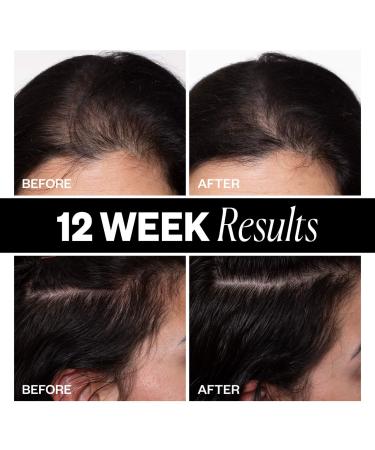 Shop IGK Sponsored Hair Density Scalp Treatment for Thinning Hair - 2.1 oz / 63 ml Online - Best Price & International Shipping - Buy Online on GoSupps.com