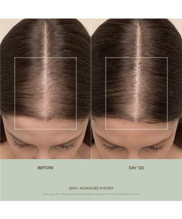 Shop Vegamour GRO+ Advanced Hair Serum Trio Set for Thinning Hair for Thinning Hair - na Online - Best Price & International Shipping - Buy Online on GoSupps.com