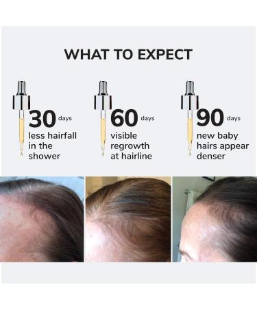 Shop COLOR WOW Youth Juice Collagen Scalp Serum for Thinning Hair - 1.7 oz / 50 mL Online - Best Price & International Shipping - Buy Online on GoSupps.com